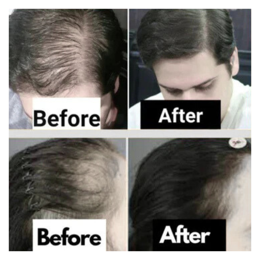 Rosemary Hair Serum 30ml