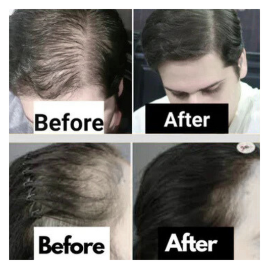 Rosemary Hair Serum 30ml